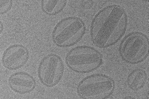liposomes